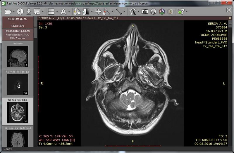 radiant dicom viewer free download for mac