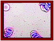 гемосканирование, бактериальное обсеменение плазмы крови