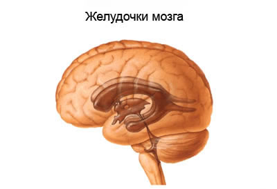 Желудочик мозга, внутричерепное давление, внутричерепное давление со рвотой, внутричерепное давление с головной болью, внутричерепное давление с гипертонией, причина внутричерепного давления, причина возникновения внутричерепного давления, лечение внутричерепного давления в Москве, признаки внутричерепного давления, симптомы внутричерепного давления, источник внутричерепного давления, схема лечения внутричерепного давления, как лечить внутричерепное давление, чем лечить внутричерепное давление, где лечить внутричерепное давление, как лечат внутричерепное давление, снять внутричерепное давление, как снять внутричерепное давление, внутричерепное давление у ребёнка, внутричерепное давление после травмы, диагностика внутричерепного давления, внутричерепное давление у пожилых людей, управление внутричерепным давлением, лекарства от внутричерепного давления, препараты от внутричерепного давления, лекарства при внутричерепном давлении, препараты при внутричерепном давлении, клиника лечения внутричерепного давления, где лечат внутричерепное давление, внутричерепное давление клиники, внутричерепная гипертензия, гидроцефалия