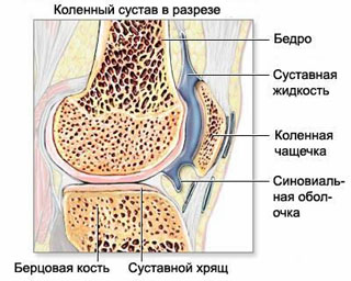 Анатомия коленного сустава в норме (связки, мениск, суставной хрящ), Заболевания коленного сустава: артрит, артроз, остеоартроз, гонартроз, Артрит коленного сустава, артрит коленного сустава, артроз коленного сустава, суставная жидкость, суставной хрящ, остеоартроз коленного сустава, диагностика коленного сустава, лечение коленного сустава, диагностика гонартроза, лечение гонартроза