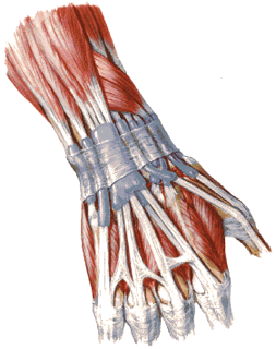 Анатомия связок лучезапястного сустава в норме (вид сверху) показывает излюбленные места появления гигромы кисти, Гигрома, диагностика гигромы, лечение гигромы в Санкт-Петербурге, удаление гигромы, запястье, кисть, рука